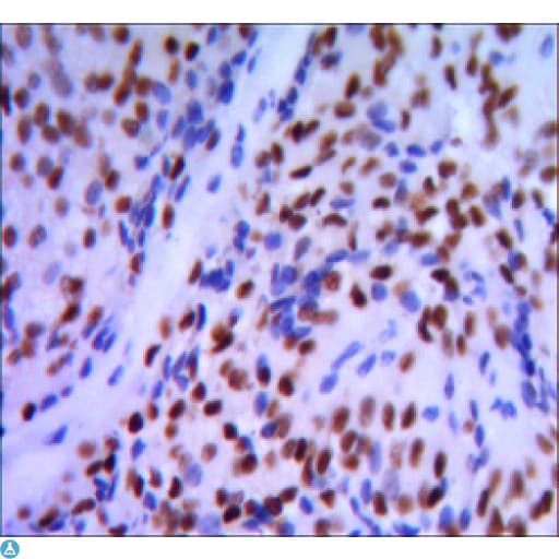 Monoclonal Mouse anti-Human GATA1 Antibody (IHC, IF, WB)