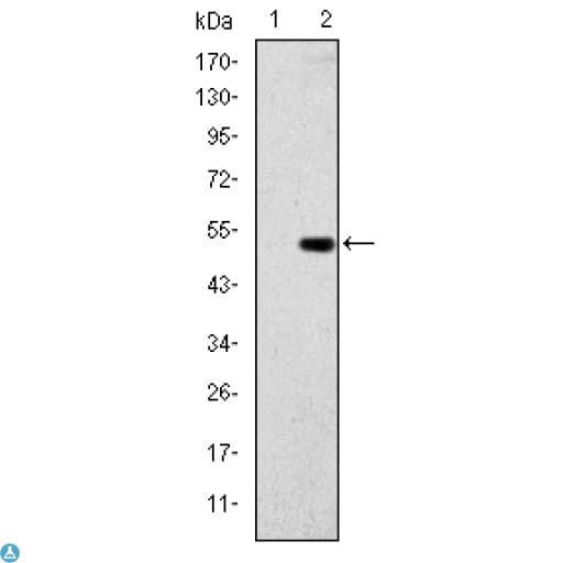 Monoclonal Mouse anti-Human GCK / Glucokinase Antibody (WB)