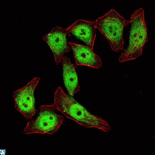 Monoclonal Mouse anti-Human KLF4 Antibody (IHC, IF, WB)