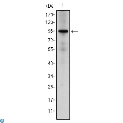 Monoclonal Mouse anti-Human NR3C1/Glucocorticoid Receptor Antibody (IHC, IF, WB)