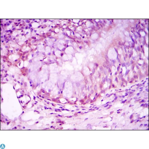 Monoclonal Mouse anti-Human NR3C1/Glucocorticoid Receptor Antibody (IHC, IF, WB)