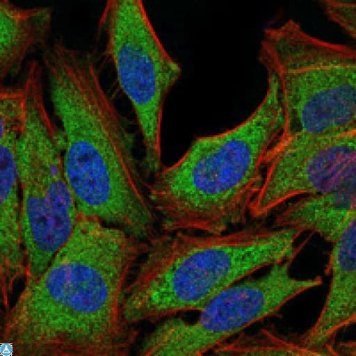Monoclonal Mouse anti-Human NR3C1/Glucocorticoid Receptor Antibody (IHC, IF, WB)