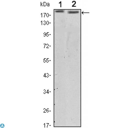 Monoclonal Mouse anti-Human ERBB2 / HER2 Antibody (IHC, WB)