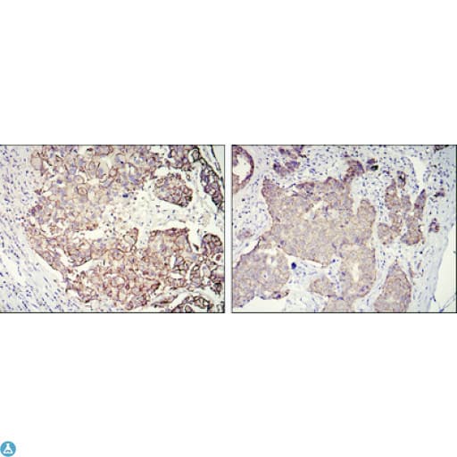 Monoclonal Mouse anti-Human ERBB2 / HER2 Antibody (IHC, WB)