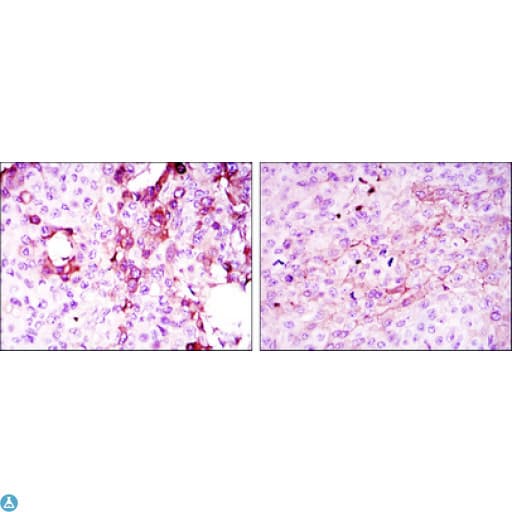 Monoclonal Mouse anti-Human OPG / Osteoprotegerin Antibody (IHC, WB)