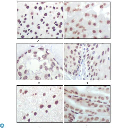 Monoclonal Mouse anti-Human p16INK4a / CDKN2A Antibody (IHC, WB)