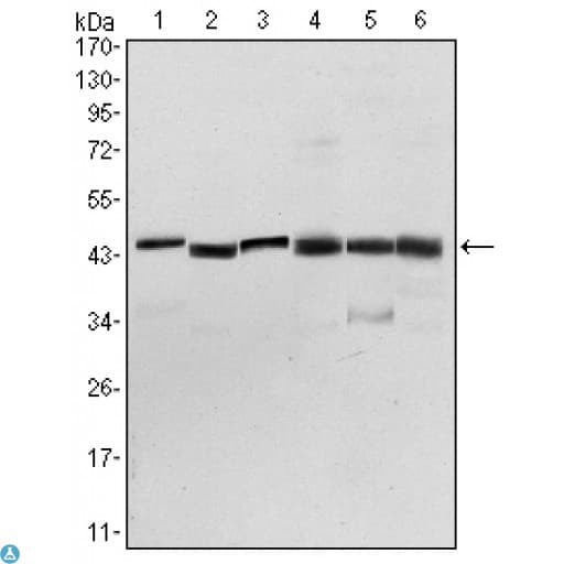 Monoclonal Mouse anti-Human PDK1 Antibody (IHC, IF, WB)