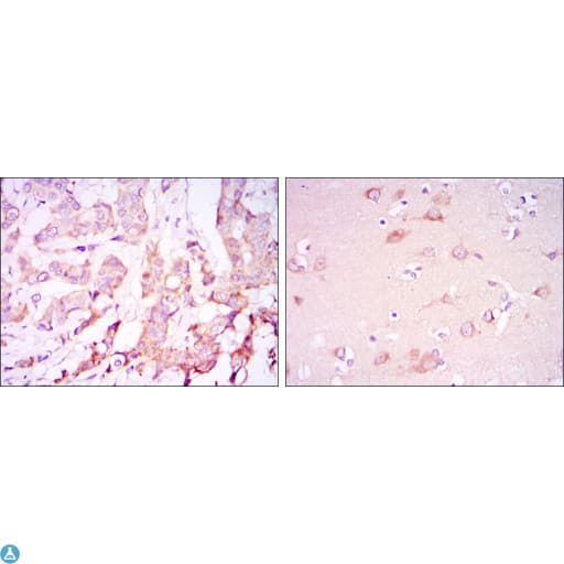 Monoclonal Mouse anti-Human PDK1 Antibody (IHC, IF, WB)