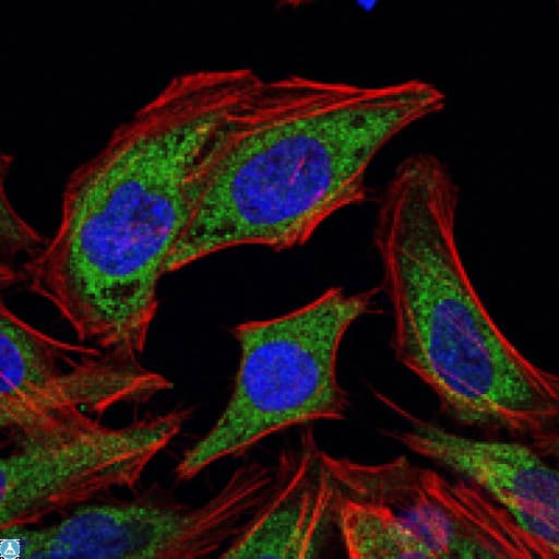 Monoclonal Mouse anti-Human PDK1 Antibody (IHC, IF, WB)
