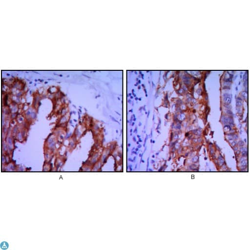 Monoclonal Mouse anti-Human PLAP / Alkaline Phosphatase Antibody (IHC, WB)