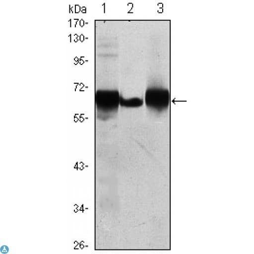 Monoclonal Mouse anti-Human PLAP / Alkaline Phosphatase Antibody (IHC, WB)