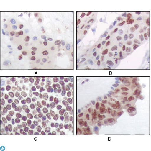 Monoclonal Mouse anti-Human MAPKAPK5 / PRAK Antibody (IHC, WB)