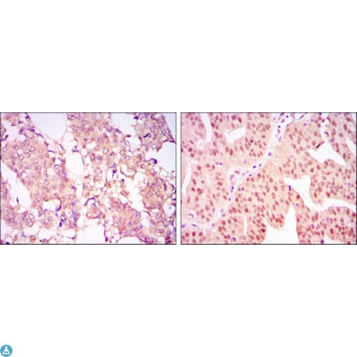 Monoclonal Mouse anti-Human PRMT4 / CARM1 Antibody (IHC, IF, WB)