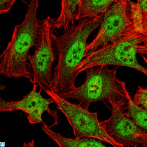 Monoclonal Mouse anti-Human PRMT4 / CARM1 Antibody (IHC, IF, WB)