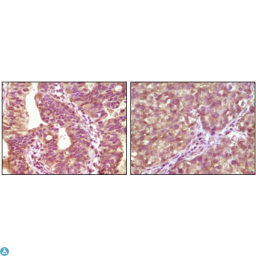 Monoclonal Mouse anti-Human BRAF / B-Raf Antibody (IHC, WB)