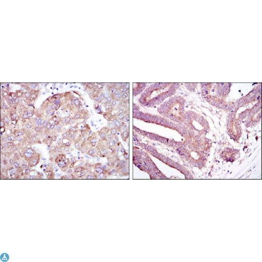 Monoclonal Mouse anti-Human RBP4 Antibody (IHC, IF, WB)