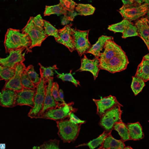 Monoclonal Mouse anti-Human RBP4 Antibody (IHC, IF, WB)
