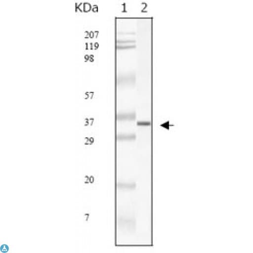 SARS-CoV M Protein Antibody