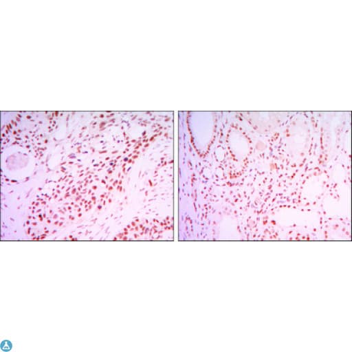 Monoclonal Mouse anti-Human SIRT1 / Sirtuin 1 Antibody (IHC, IF, WB)