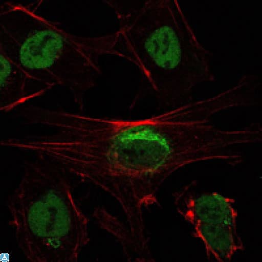 Monoclonal Mouse anti-Human SIRT1 / Sirtuin 1 Antibody (IHC, IF, WB)