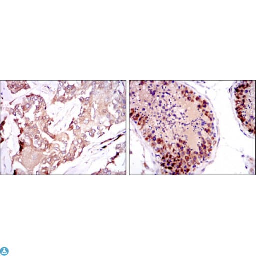 Monoclonal Mouse anti-Human SMN1 Antibody (IHC, IF, WB)