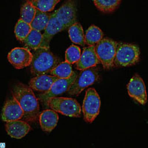 Monoclonal Mouse anti-Human SMN1 Antibody (IHC, IF, WB)