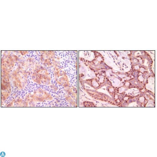 Monoclonal Mouse anti-Human SNCG / Gamma-Synuclein Antibody (IHC, WB)