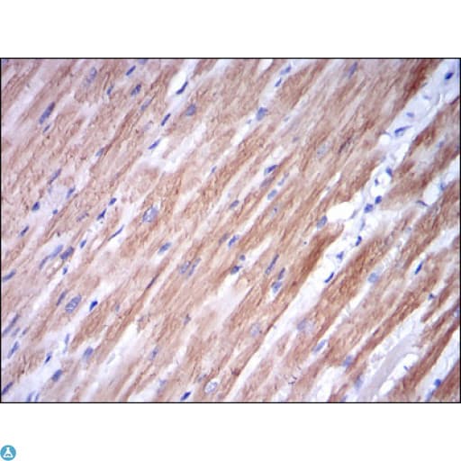Monoclonal Mouse anti-Human TNNI2 Antibody (IHC, WB)