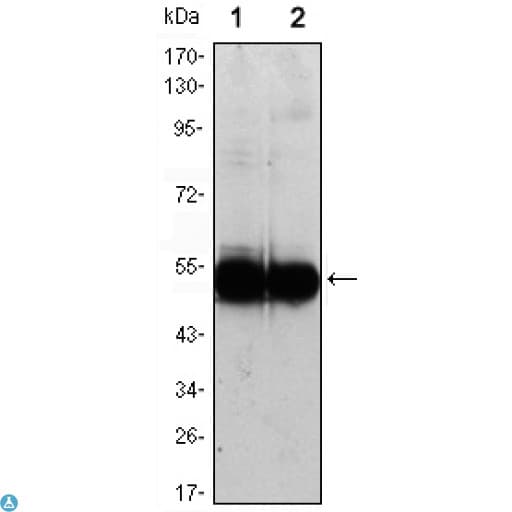 Monoclonal Mouse anti-Human VCAM1 / CD106 Antibody (IHC, WB)