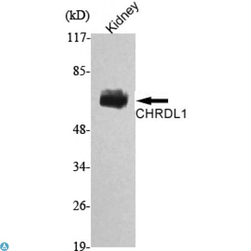 Monoclonal Mouse anti-Human CHRDL1 Antibody (WB)