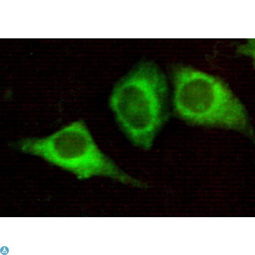 KRT7 / CK7 / Cytokeratin 7 Antibody