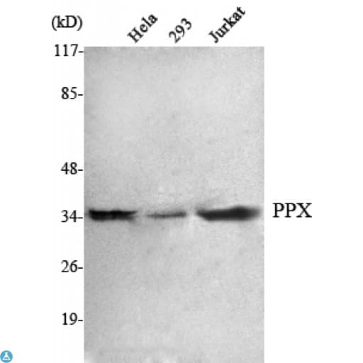 Monoclonal Mouse anti-Human PPX Antibody (IHC, IF, WB)