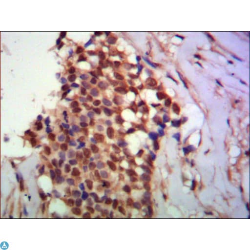 Monoclonal Mouse anti-Human PPX Antibody (IHC, IF, WB)