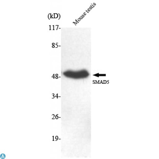 Monoclonal Mouse anti-Human SMAD5 Antibody (IF, WB)