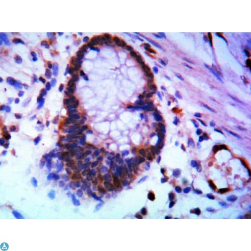 Monoclonal Mouse anti-Human SOCS3 Antibody (IHC, WB)