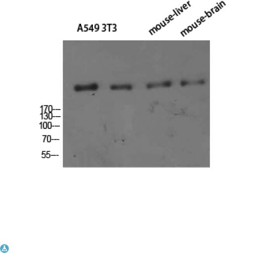 Polyclonal Rabbit anti-Human CR1 / CD35 Antibody (WB)