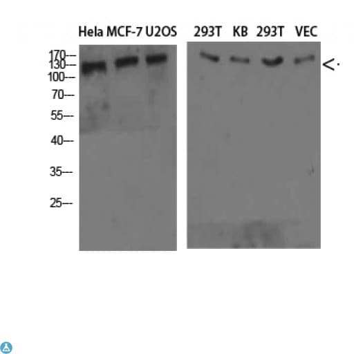 Polyclonal Rabbit anti-Human Collagen IV Antibody (WB)