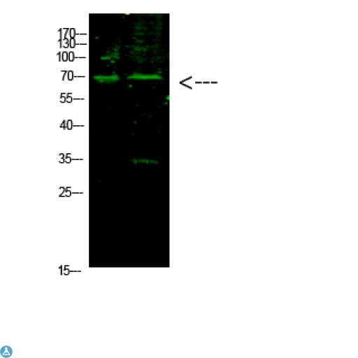 Polyclonal Rabbit anti-Human PARP1 Antibody (WB)