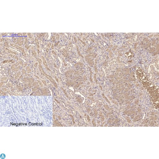 Monoclonal Mouse anti-Human TTR / Transthyretin Antibody (WB)