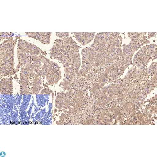 Monoclonal Mouse anti-Human TTR / Transthyretin Antibody (WB)
