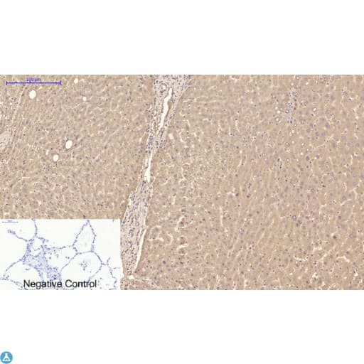 Monoclonal Mouse anti-Human TTR / Transthyretin Antibody (WB)