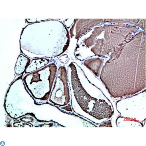 Monoclonal Mouse anti-Human TTR / Transthyretin Antibody (WB)