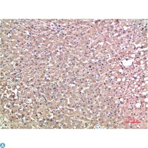 Monoclonal Mouse anti-Human TTR / Transthyretin Antibody (WB)