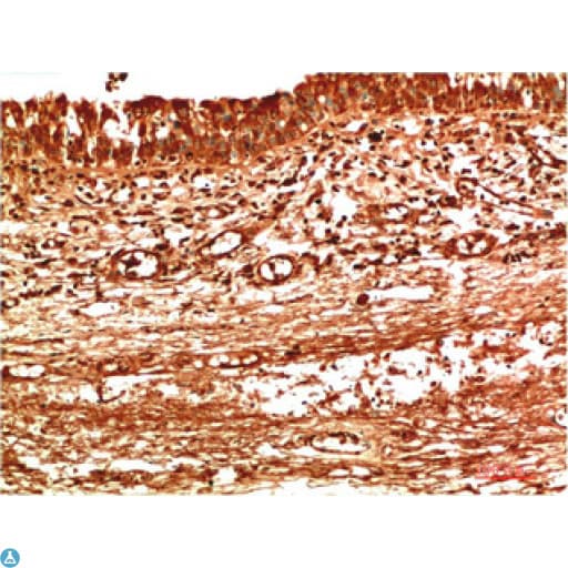 Monoclonal Mouse anti-Human TTR / Transthyretin Antibody (WB)