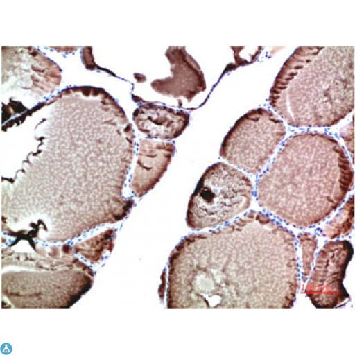 Monoclonal Mouse anti-Human TTR / Transthyretin Antibody (WB)