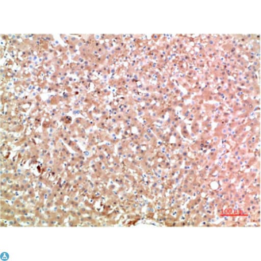 TTR / Transthyretin Antibody