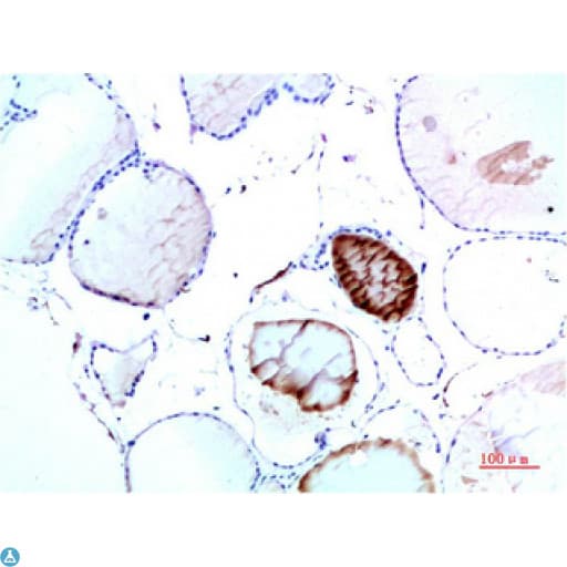 Monoclonal Mouse anti-Human TTR / Transthyretin Antibody (WB)
