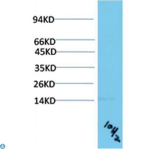 Monoclonal Mouse anti-Human TTR / Transthyretin Antibody (WB)