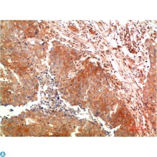 Monoclonal Mouse anti-Human APG5 / ATG5 Antibody (WB)