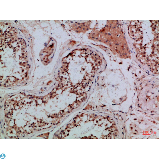 Tubulin Gamma Antibody